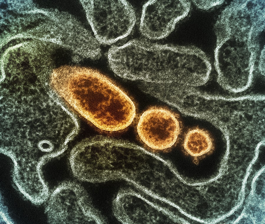 Gut bacteria