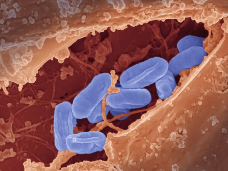 Photo Gut bacteria